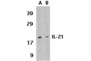 Western blot analysis of IL-21 expression in HL-60 cell lysate in the absence (lane A) or presence of blocking peptide (lane B) with AP30413PU-N IL-21 antibody at 1 μg /ml. (IL-21 Antikörper  (Intermediate Domain))