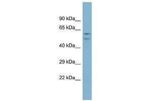 ATP6V1B1 antibody used at 1 ug/ml to detect target protein. (ATP6V1B1 Antikörper  (Middle Region))