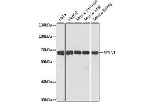 Western blot analysis of extracts of various cell lines using SYVN1 Polyclonal Antibody at dilution of 1:1000. (SYVN1 Antikörper)