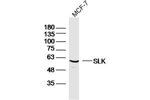 MCF-7 lysates probed with SLK Polyclonal Antibody, Unconjugated  at 1:300 dilution and 4˚C overnight incubation.