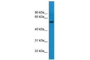 Western Blot showing CNDP1 antibody used at a concentration of 1-2 ug/ml to detect its target protein. (CNDP1 Antikörper  (C-Term))