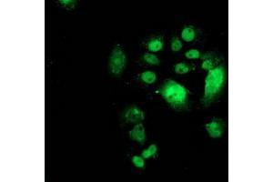 Anti-CDK2 mouse monoclonal antibody (ABIN2454523) immunofluorescent staining of COS7 cells transiently transfected by pCMV6-ENTRY CDK2 (RC200494). (CDK2 Antikörper)