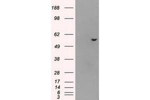 HEK293T cells were transfected with the pCMV6-ENTRY control (Left lane) or pCMV6-ENTRY ATP5B (Right lane) cDNA for 48 hrs and lysed. (ATP5B Antikörper)