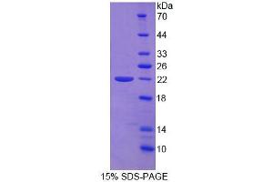 SDS-PAGE analysis of Human vWFCP Protein.