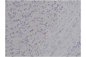 ABIN6256508 and ABIN6267358 at 1/200 staining Rat ganstric tissue sections by IHC-P.