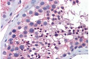 Immunohistochemistry (Formalin-fixed Paraffin-embedded Sections) (IHC (fp)) image for anti-Wingless-Type MMTV Integration Site Family, Member 10A (WNT10A) (AA 101-150) antibody (ABIN6747192)
