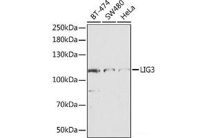 Western blot analysis of extracts of various cell lines using LIG3 Polyclonal Antibody at dilution of 1:1000. (LIG3 Antikörper)