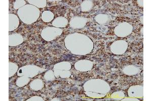 Immunostaining (ISt) image for anti-Major Histocompatibility Complex, Class II, DM alpha (HLA-DMA) (AA 1-261) antibody (ABIN561267)