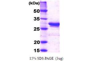 SDS-PAGE (SDS) image for Complement Component 1, Q Subcomponent Binding Protein (C1QBP) (AA 74-282) protein (ABIN666710) (C1QBP Protein (AA 74-282))
