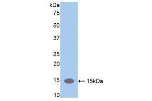 Western blot analysis of recombinant Mouse LIFR. (LIFR Antikörper  (AA 381-485))