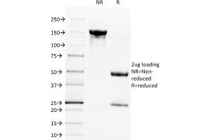 SDS-PAGE Analysis Purified CD28 Mouse Monoclonal Antibody (C28/1636). (CD28 Antikörper)