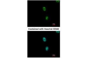 ICC/IF Image Immunofluorescence analysis of methanol-fixed HeLa, using SAP130, antibody at 1:500 dilution. (SF3B3 Antikörper  (C-Term))