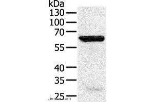 Western blot analysis of Jurkat cell, using TRAF5 Polyclonal Antibody at dilution of 1:450 (TRAF5 Antikörper)
