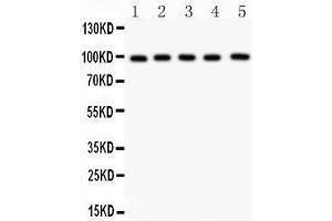 Anti- ASPH Picoband antibody, Western blotting All lanes: Anti ASPH  at 0. (Aspartate beta Hydroxylase Antikörper  (C-Term))