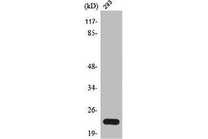 Western Blot analysis of 293 cells using Trypsin-1 Polyclonal Antibody (PRSS1 Antikörper  (Internal Region))
