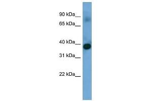Western Blot showing SFXN4 antibody used at a concentration of 1-2 ug/ml to detect its target protein. (Sideroflexin 4 Antikörper  (N-Term))