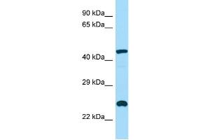 WB Suggested Anti-INPP5A Antibody Titration: 1. (INPP5A Antikörper  (C-Term))