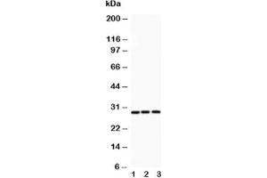 Western blot testing of ATF1 antibody and Lane 1:  rat spleen;  2: HeLa;  3: COLO320 (AFT1 Antikörper  (AA 1-271))