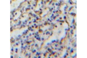 IHC-P analysis of Spleen tissue, with DAB staining. (CD21 Antikörper  (AA 729-957))