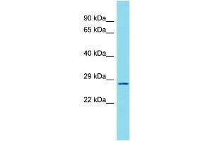 Host: Rabbit Target Name: C17orf77 Sample Type: RPMI-8226 Whole Cell lysates Antibody Dilution: 1. (C17ORF77 Antikörper  (C-Term))