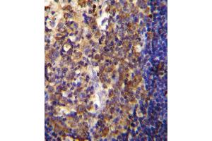 His6-DEP-1 Antibody (ABIN655037 and ABIN2844669) immunohistochemistry analysis in formalin fixed and paraffin embedded human tonsil tissue followed by peroxidase conjugation of the secondary antibody and DAB staining. (PTPRJ Antikörper  (His6))