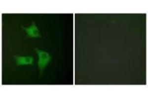 Immunofluorescence analysis of HeLa cells, using p15 INK antibody. (CDKN2B Antikörper)