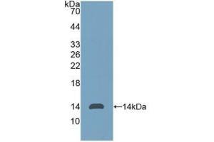 Detection of Recombinant Thy1, Human using Polyclonal Antibody to Cluster of Differentiation 90 (CD90) (CD90 Antikörper  (AA 20-133))