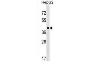 Western Blotting (WB) image for anti-Leucine Rich Repeat Protein 1 (LRR1) antibody (ABIN2999950) (PPIL5 Antikörper)