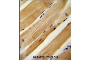 MLXIP antibody (N-term) (ABIN654186 and ABIN2844037) immunohistochemistry analysis in formalin fixed and paraffin embedded human skeletal muscle followed by peroxidase conjugation of the secondary antibody and DAB staining. (MLXIP Antikörper  (N-Term))