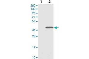Western blot analysis of Lane 1: Negative control (vector only transfected HEK293T lysate), Lane 2: Over-expression Lysate (Co-expressed with a C-terminal myc-DDK tag (~3. (ERGIC1 Antikörper)