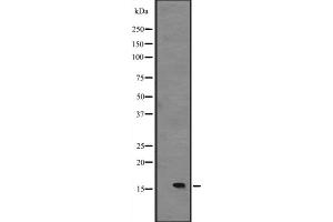 Western blot analysis of IL15 expression in Foetal liver lysate,The lane on the left is treated with the antigen-specific peptide. (IL-15 Antikörper  (Internal Region))