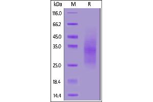 Human  RII, His Tag on  under reducing (R) condition. (TGFBR2 Protein (AA 23-159) (His tag))