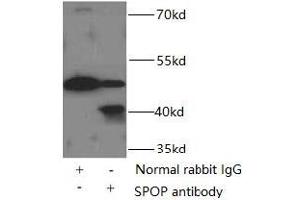 IP analysis of HeLa cell lysates (3000 μg), using SPOP antibody (1/500 dilution, 3 μg). (SPOP-B Antikörper)