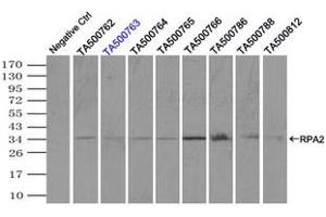 Image no. 8 for anti-Replication Protein A2, 32kDa (RPA2) antibody (ABIN1500733)