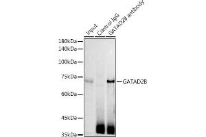 Immunoprecipitation analysis of 300 μg extracts of Jurkat cells using 3 μg GB antibody (ABIN6127943, ABIN6140978, ABIN6140979 and ABIN6225075). (GATAD2B Antikörper  (AA 1-120))