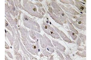 Immunohistochemistry analyzes of Pax-1 antibody in paraffin-embedded human heart tissue. (PAX1 Antikörper)
