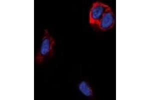 Immunofluorescence (IF) image for anti-Taste Receptor, Type 2, Member 14 (TAS2R14) antibody (ABIN7304386)