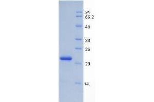 SDS-PAGE analysis of Rat Insulin Like Growth Factor Binding Protein 3 (IGFBP3) Protein.