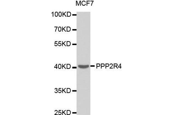 PPP2R4 Antikörper  (AA 1-323)