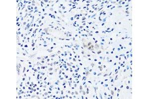 Immunohistochemistry (Paraffin-embedded Sections) (IHC (p)) image for anti-BRX1, Biogenesis of Ribosomes, Homolog (BRIX1) antibody (ABIN7257894)