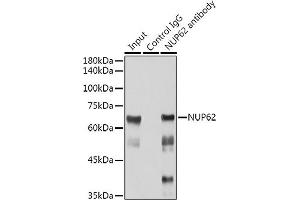 Immunoprecipitation analysis of 300 μg extracts of Jurkat cells using 3 μg NUP62 antibody (ABIN7269045). (NUP62 Antikörper)