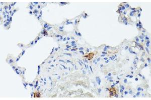 Immunohistochemistry of paraffin-embedded Rat lung using TIAL1 Polyclonal Antibody at dilution of 1:100 (40x lens). (TIAL1 Antikörper)