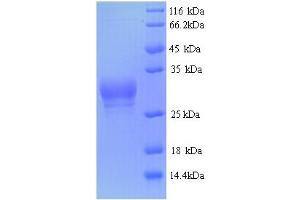 Probable Serine/threonine-Protein Phosphatase 2A Regulatory Subunit B'' Subunit TON2 (FASS) (AA 1-28), (full length) protein (GST tag)