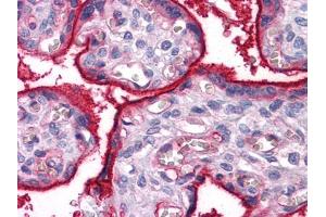 Immunohistochemical analysis of paraffin-embedded human Placenta tissues using ITGA5 mouse mAb (ITGA5 Antikörper)