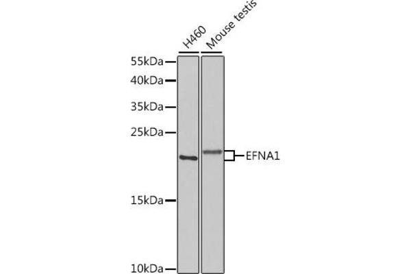 Ephrin A1 Antikörper  (AA 19-182)