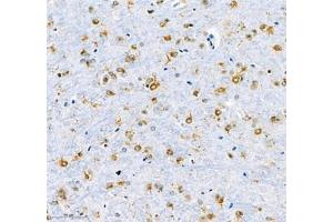 Immunohistochemistry (Paraffin-embedded Sections) (IHC (p)) image for anti-Microtubule-Associated Protein 7 (MAP7) antibody (ABIN7074621)