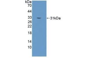 Detection of Recombinant KLK2, Human using Polyclonal Antibody to Kallikrein 2 (KLK2) (Kallikrein 2 Antikörper  (AA 19-261))