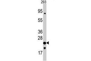Western blot analysis of FXN polyclonal antibody  in 293 cell line lysates (35 ug/lane). (Frataxin Antikörper  (C-Term))