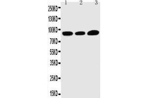 Anti-TRPV3 antibody, Western blotting Lane 1: HELA Cell Lysate Lane 2: A549 Cell Lysate Lane 3: MCF-7 Cell Lysate
