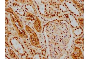 IHC image of ABIN7127541 diluted at 1:154 and staining in paraffin-embedded human kidney tissue performed on a Leica BondTM system.